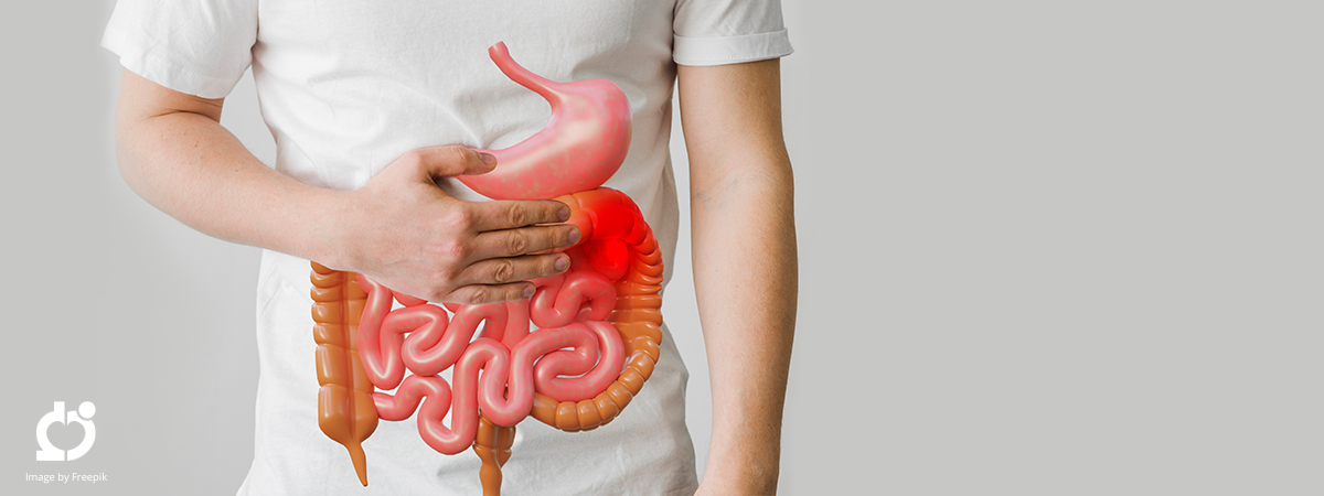 Ire Malattie Rare Tumore Del Colon Retto Istituti Fisioterapici Ospitalieri Ifo